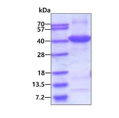 SDS-PAGE: Recombinant Human N myc interactor His Protein [NBP1-50958]